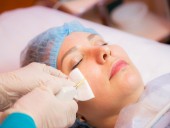 Карбокситерапия - это лечебно-омолаживающая методика, основанная на подкожных введениях углекислого газа